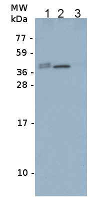 Western blot using anti-Fructose-bisphosphate aldolase 1, chloroplastic antibodies